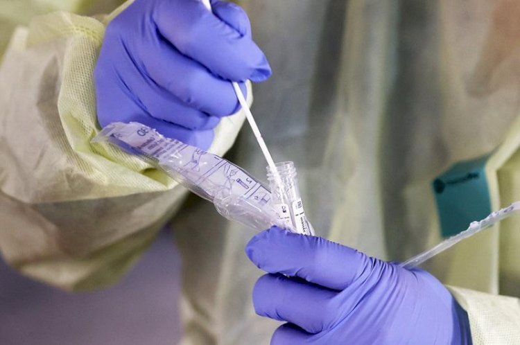 Кеше 5721 адамнан коронавирус инфекциясы анықталды