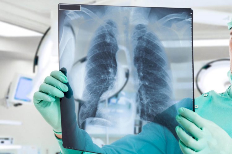 Коронавирус пневмониясымен ауырған 5 науқас қайтыс болды