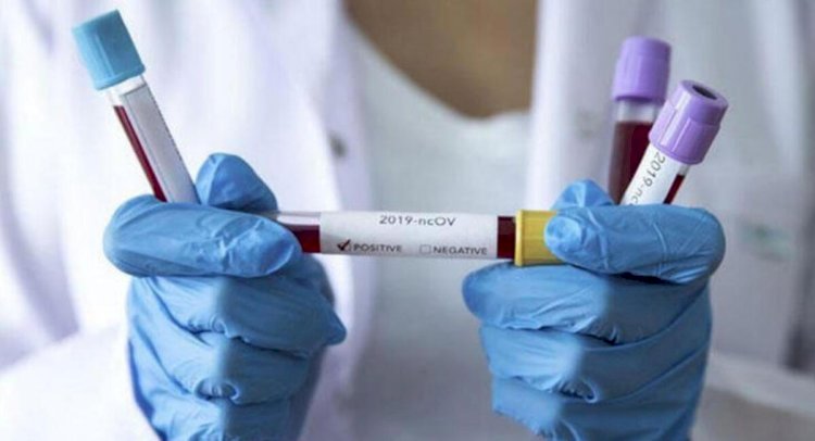 Кеше қанша адамнан коронавирус анықталғаны белгілі болды