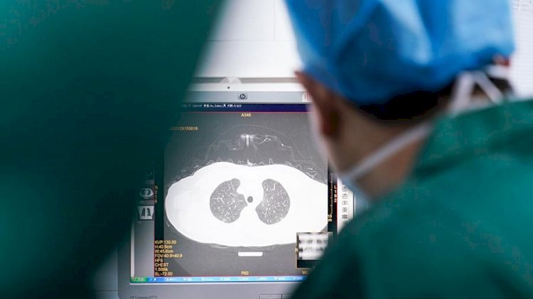 Коронавирустық пневмониядан 28 адам емделіп шықты