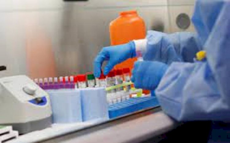 Қазақстан өңірлеріндегі эпидемиологиялық ахуал қандай