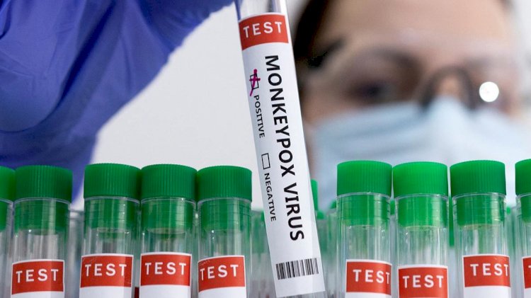 Вашингтонда маймыл шешегі өршіп тұр