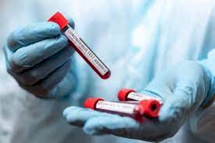 Өткен тәулікте 2480 адамнан коронавирус анықталды