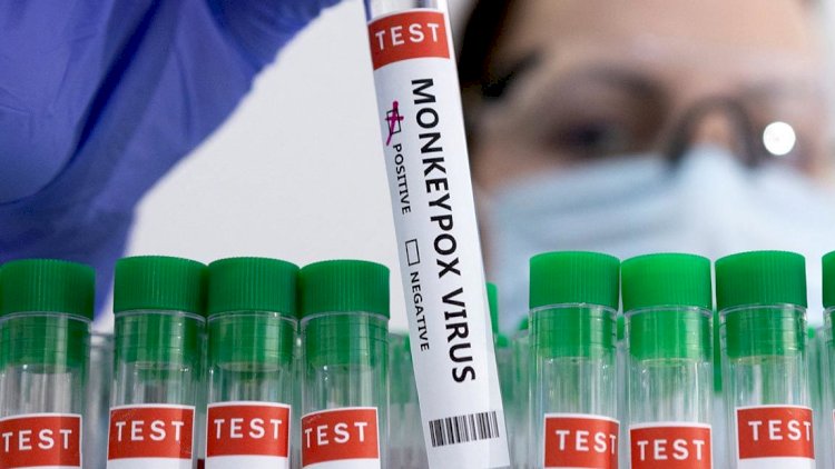 Маймыл шешегіне  ПТР-тестілеуді кімдер тапсырады?