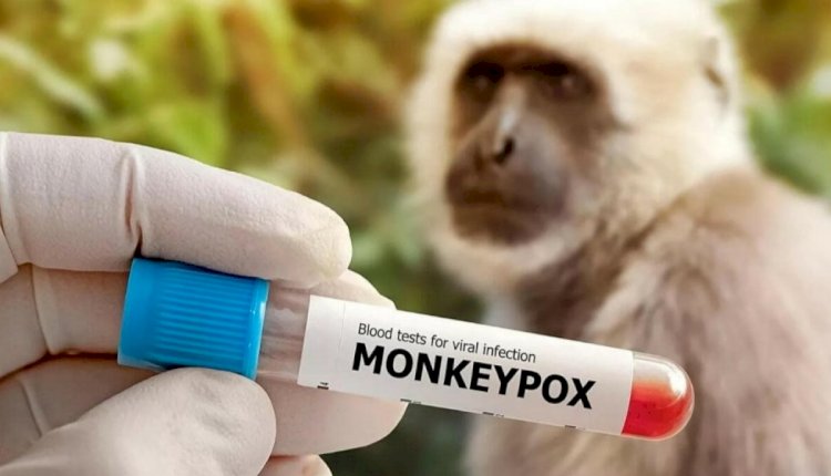 Әлемде маймыл шешегі дерті ушығып тұр