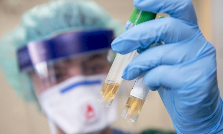 Елімізде өткен тәулікте 69 адам коронавирус жұқтырды