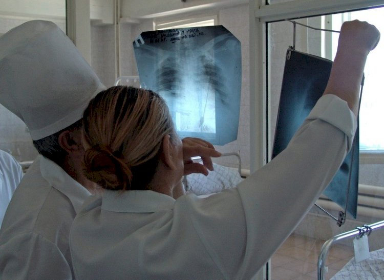 Алматыда оқу жылы басталғалы 39 баладан туберкулез табылды