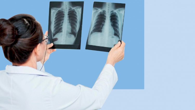 Министрлік тұмауға қарсы вакцина пневмонияның алдын алатынын мәлімдеді