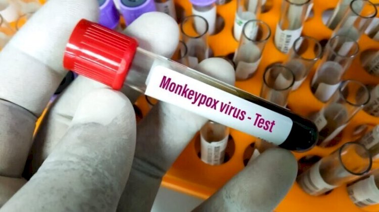 Маймыл шешегінің атауы mpox деп өзгертілді