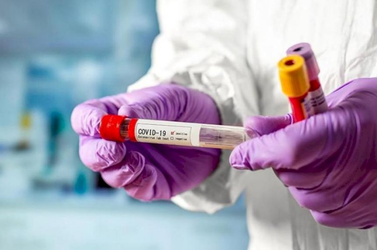 Соңғы  тәулікте 140 адамнан коронавирус анықталды