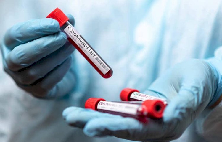 Бір тәулікте 202 адамнан коронавирус инфекциясы анықталды