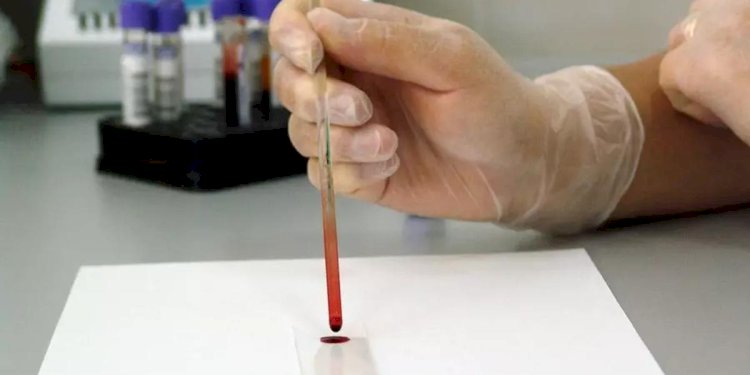 Қандай өнімдер қан құрамын қоюлатады?