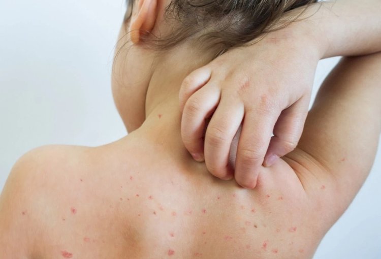 Алматы мен Шымкентте эпидахуал күрделі