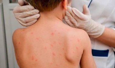 Қызылшаға байланысты мектептер карантинге жабыла ма?