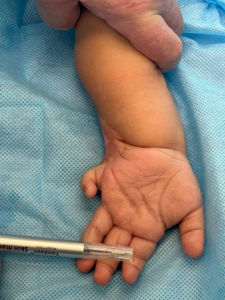 16 балаға Санкт-Петербург пен Алматының жетекші мамандары операция жасады