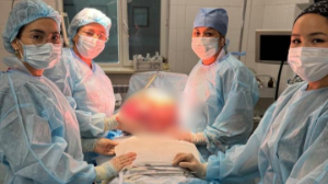 Дәрігерлер салмағы 15 келі болатын миоманы алып тастады