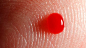 Сирек кездесетін аурулардан адамзаттың әрбір оныншысы зардап шегеді