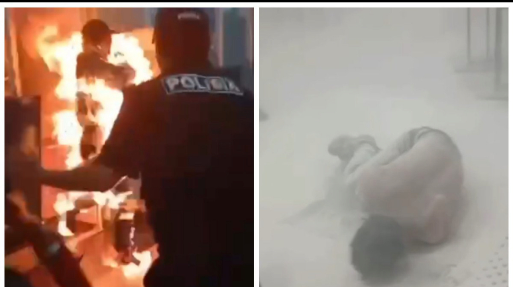 Алматы әуежайында өзін өртеп жіберген ер адамның жағдайы өте ауыр