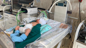 Алматылық дәрігерлер 742 грамм сәбиді аман алып қалды