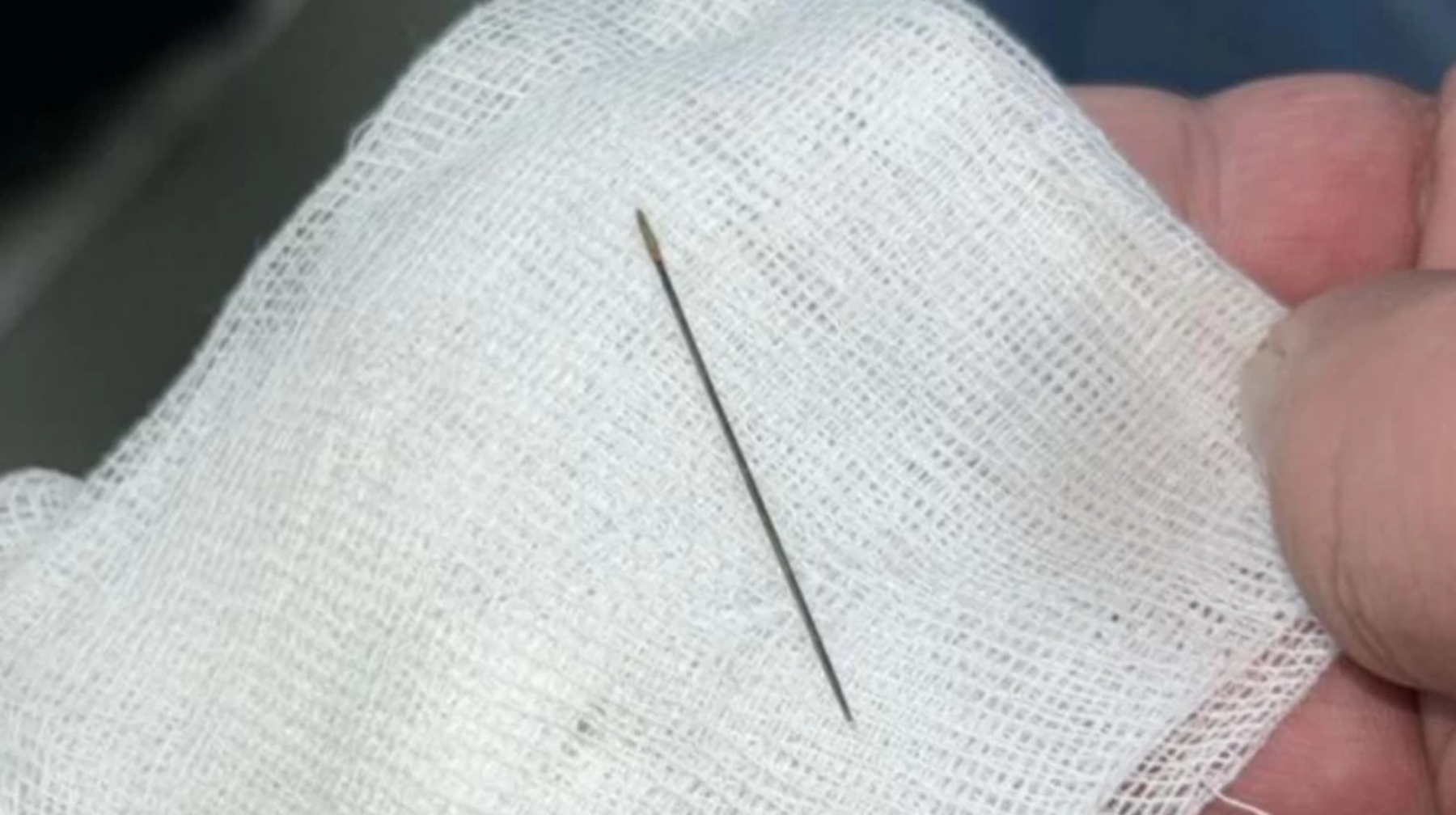 8 айлық баланың ішкі құрылысынан ине табылды